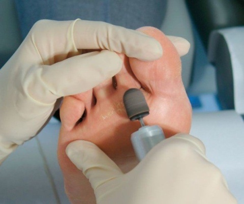 Nośnik gumowy do kapturków 10 mm