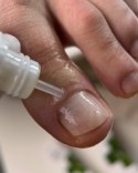 Resultum Onistopix Oil - olejek regenerujący dla paznokci z onycholizą, 15 ml
